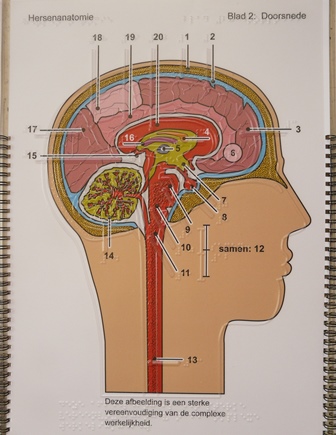 Afbeelding van een doorsnede van de hersenen